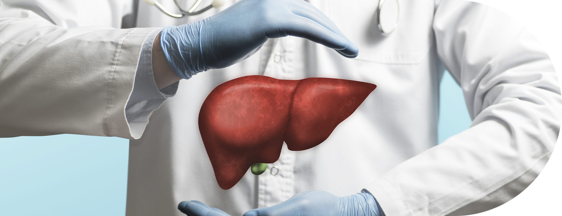 Imagem Câncer do fígado e das vias biliares