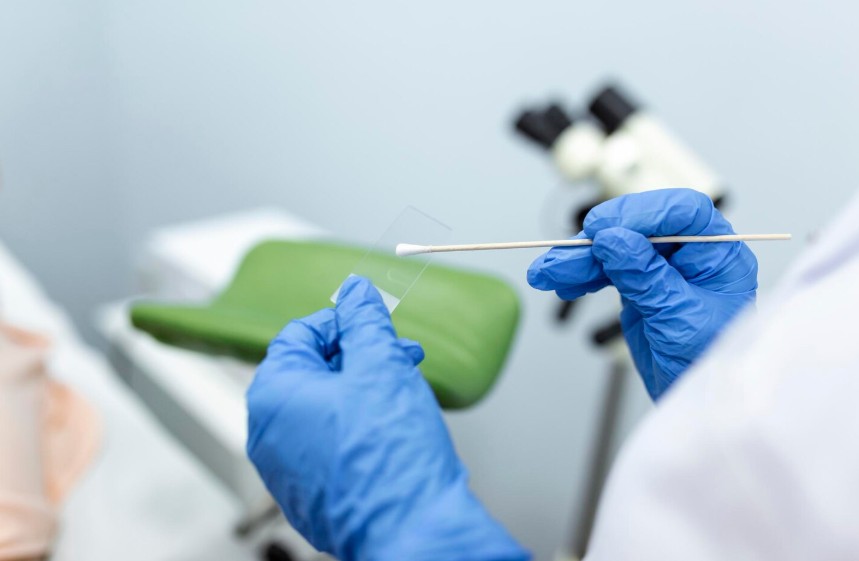 Biópsia do endométrio: como entender o resultado e quais alterações podem aparecer no laudo?