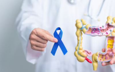 Tratamentos para câncer colorretal: entenda as opções e avanços da medicina