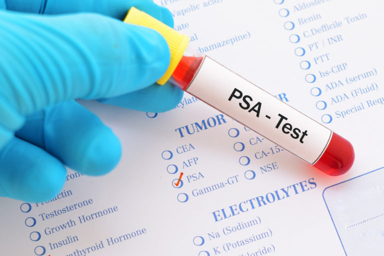 PSA alterado significa câncer? Entenda o que pode causar mudanças no exame — O que fazer ao receber um resultado de PSA alterado