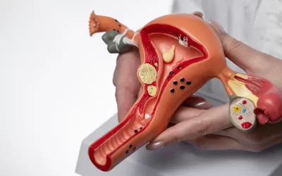 Sintomas de câncer no colo do útero: sinais que merecem atenção